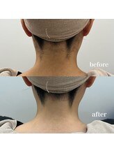 ラクシー 御徒町(luxssy)/うなじシェービング