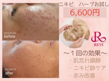 ブランリス(Blanclis)