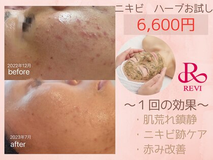 ブランリス(Blanclis)の写真