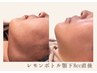 韓国発★速効効果実感！脂肪分解　【レモンボトル】　顎下　￥11000→¥6600
