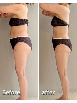 ヒールプラス(heal+)/3ヶ月通っていただきました