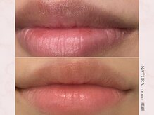 ナチュラルーム 那覇(NATURA room)/ローマピンク/リップ施術