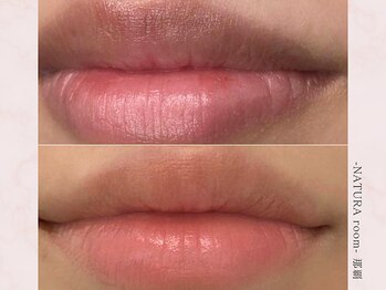 ナチュラルーム 那覇(NATURA room)/ローマピンク/リップ施術