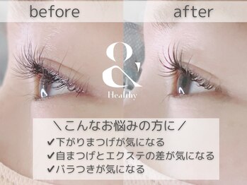 アイアンドネイル ブライト(bright)