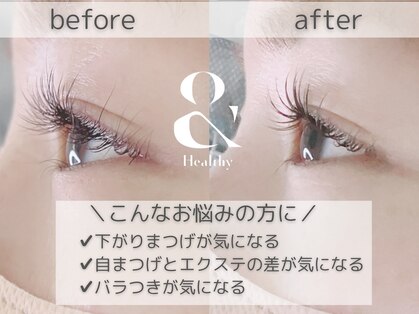 アイアンドネイル ブライト(bright)の写真