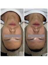 サラン(SALON)/メンズ　ビフォーアフター