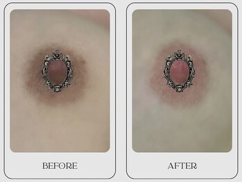 ミックス(mixx.)/リターンピンクビフォーアフター