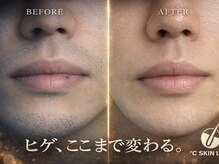 ドシースキンラボ 半蔵門四谷店(℃ SKIN LAB)
