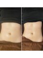 アスフィット 亀有(ASFiT)&nbsp;お腹のくびれも得意です！お任せください！
