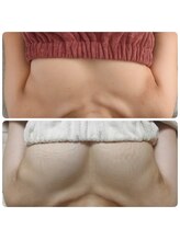 美人バスト リグラス(ReGrous)/バストアップbefore,after