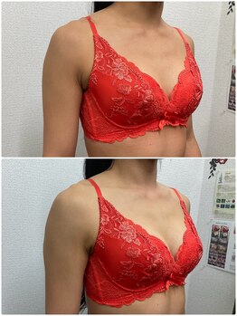 バーディー(BIRDIE)/施術1回/40代