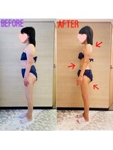 エステティックサロン アール 大阪梅田(esthetic salon R)/50代女性　横