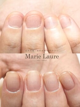 マリーロール 梅田店(Marie Laure)/深爪矯正/自爪育成/ネイルケア