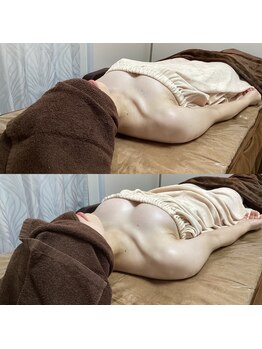 コモド(COMODO)/バストアップ・ケアbefore&after