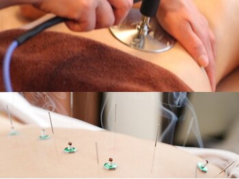 オハナルーム鍼灸治療院(OhanaRoom鍼灸治療院)の写真/【鍼灸院希少なインディバ導入】"新しい施術のカタチ"鍼灸×インディバの相乗効果で体も肌も内側から整う♪