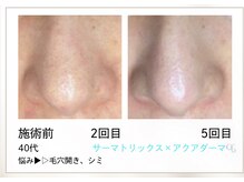 リル(Rire)/Before→After