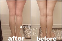 イデアルモワ(Ideal moi)