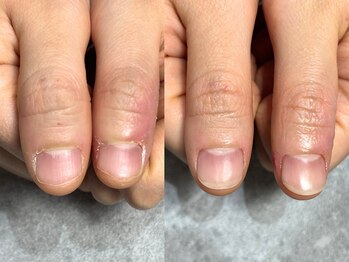 アリエ(allie)/え？これネイルしてるの？！！