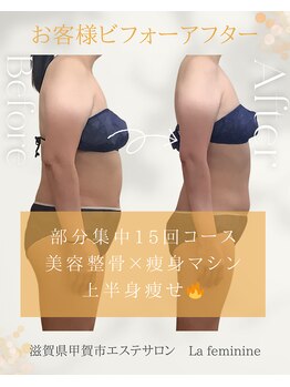 ラ フェミニン(La feminine)/50代モニター様☆上半身15回