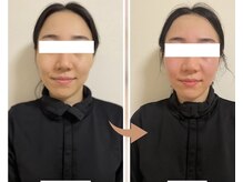 ヨサパーク レイ 等々力(YOSA PARK Ray)/お客様の変化　全身水素コース