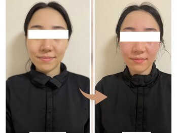 ヨサパーク レイ 等々力(YOSA PARK Ray)/お客様の変化 全身水素コース