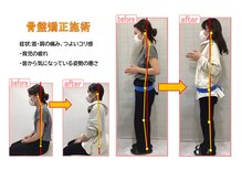 茨木いで整体院/産後の骨盤、姿勢を整えたい方へ