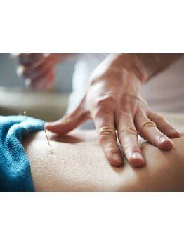 鍼灸施術を受けたい