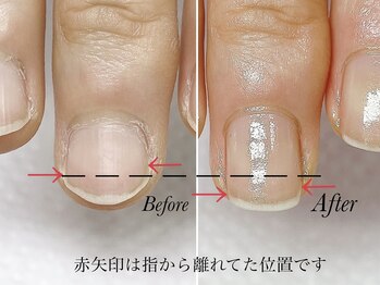 トゥインクリーネイルサロン(Twinkly Nail Salon)/【最強のネイルケア】1回お試し