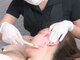 メローワックス 泉中央(MELLOW WAX)の写真/お顔のWAX脱毛でピ-リング効果&ト-ンUP!古い角質をキャッチし,お顔艶々★毛穴洗浄との相性も◎