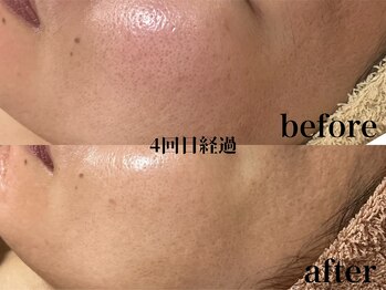 フェイシャルサロン アリイ(ALII)/