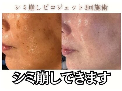 ミリ(MiLi)の写真