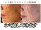 ミリ(MiLi)の写真