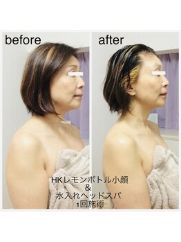 ラヴィソンファム(Ravissant femme)/50代レモンボトル＆ヘッドスパ