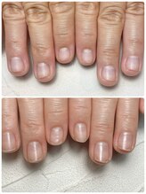 スマイルニコ(smile nico)/