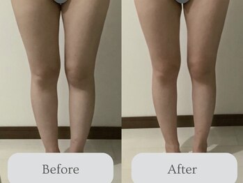 エミィ(emmy)/パワーレメディ下半身集中コース