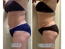 クールスパ(COOL SPA)/ &nbsp;【40代女性】お腹-6.5cm
