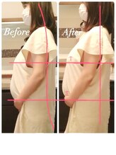 エッセンスマム 東京 プレナタールサロン(Prenatal salon)/姿勢・お腹の位置を整える