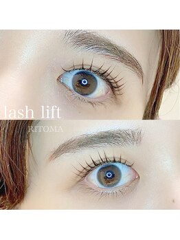 リトマ(RITOMA)/ラッシュリフト