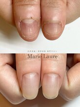 マリーロール 淀屋橋本店(Marie Laure)/自爪育成/深爪矯正/ネイルケア