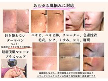 ビーナス(Venus)