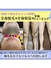 ●脱毛●全部お任せ◎【メンズ】全身脱毛＋保湿ケア＋シェービング　¥19,250