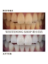 ホワイトニングショップ 新小岩店/歯科提携　ホワイトニング専門店