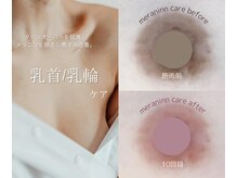 ジュエルリング(Jewel Ring)の雰囲気（バストトップ/メラニンケア/フェムケア/ローマピンク）