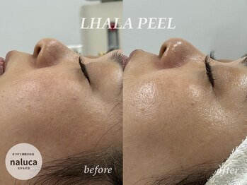 ナルカ(naluca)/【堺市・深井】ララピール