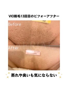 エアリアル 筑紫野店/劇的に変わります！