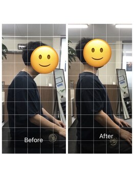 ナオル整体 センター南院(NAORU整体)/ストレートネックのBefore After