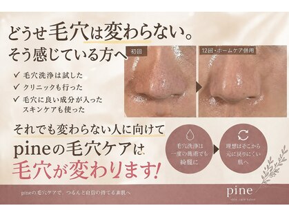 ピネ(pine)の写真