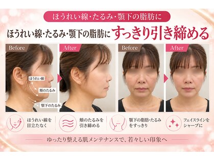 ラシクビューティールームの写真