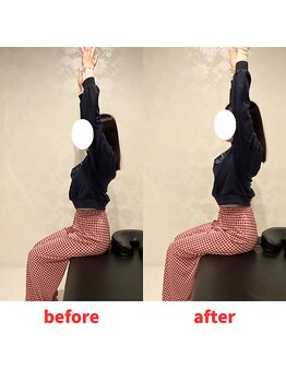 ナオル整体 福岡香椎院(NAORU整体)/20代女性施術事例【肩の痛み】