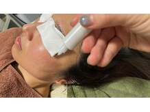 ラズ(Luz)/シミケア